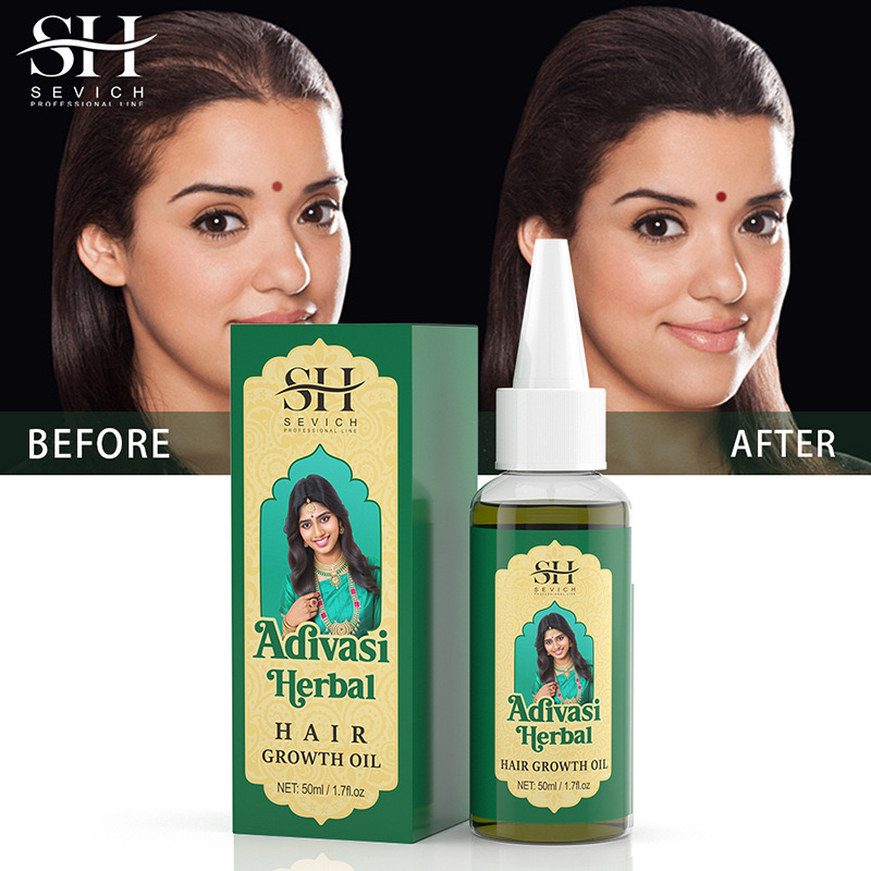 50ml 오리지널 인도 오일 Adivasi 허벌 헤어  - Ayurvedic & Herbal Wellness Kits 리뷰 및 가격